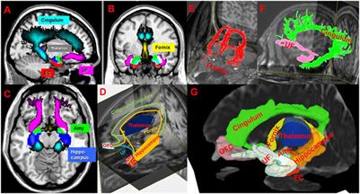 Quantitative Limbic System Mapping of Main Cognitive Domains in Multiple Sclerosis